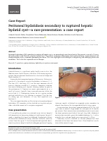 Peritoneal hydatid cyst.. Gondar.pdf